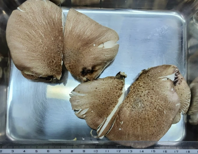 Tin AI mù quáng và cái kết nhập viện khẩn cấp